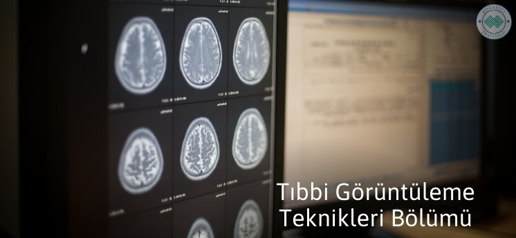 en çok tercih edilen ön lisans bölümleri tıbbi görüntüleme teknikleri